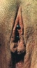 female-genital-piercing-VCH