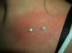 collar micro dermals