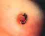 vertical-horizontal-nipple-piercing