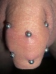 frenum-piercing